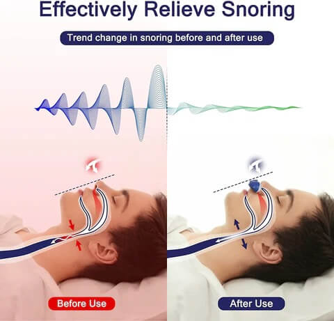 CPAP Sleep Apnea Device – Micro Compact Portable Solution for Better Sleep